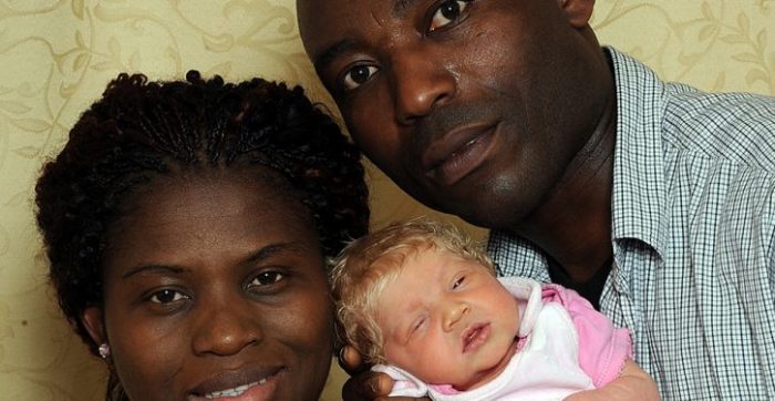 Des parents noirs donnent naissance à un bébé blanc aux yeux bleus, découvrez-les