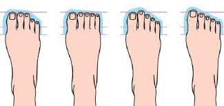 Quelle est la forme de vos pieds?￼